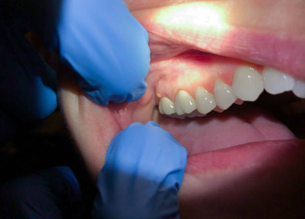 Best Emergency Treatment for Toothache in North Edwards, CA