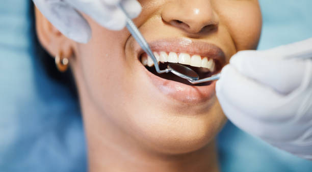 Best Same-Day Emergency Dentist in North Edwards, CA