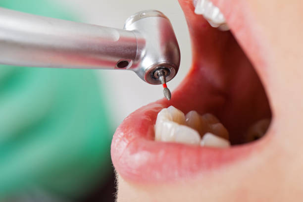 Best Pediatric Emergency Dentist in North Edwards, CA